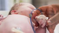 NICU nurse adjusted IV on newborn baby in incubator.